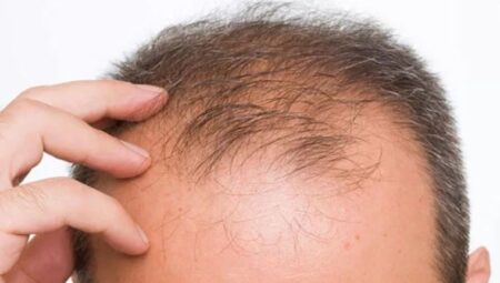 Araştırma: Enerji içeceği erkeklerde saç dökülmesine neden oluyor